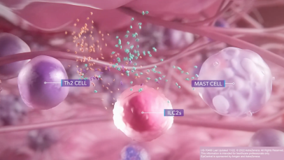 Epithelial damage and the inflammatory response - Thumbnail