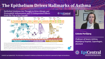 Epithelial cytokines in asthma - expert video