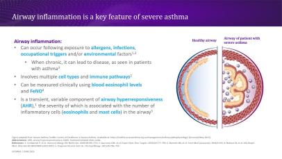 The fundamentals of airway immunology in severe asthma