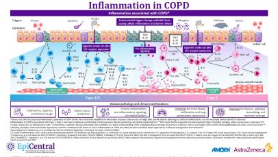 COPD Complex Inflammatory Cascade