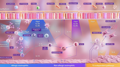 Epithelial cytokines and the inflammatory cascade - module teaser image