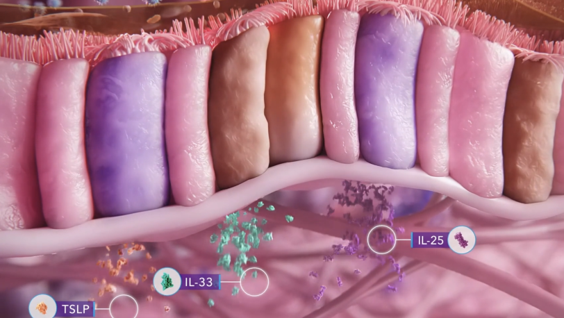 The importance of the epithelium and epithelial cytokines in uniting upper and lower airway diseases - featured module image