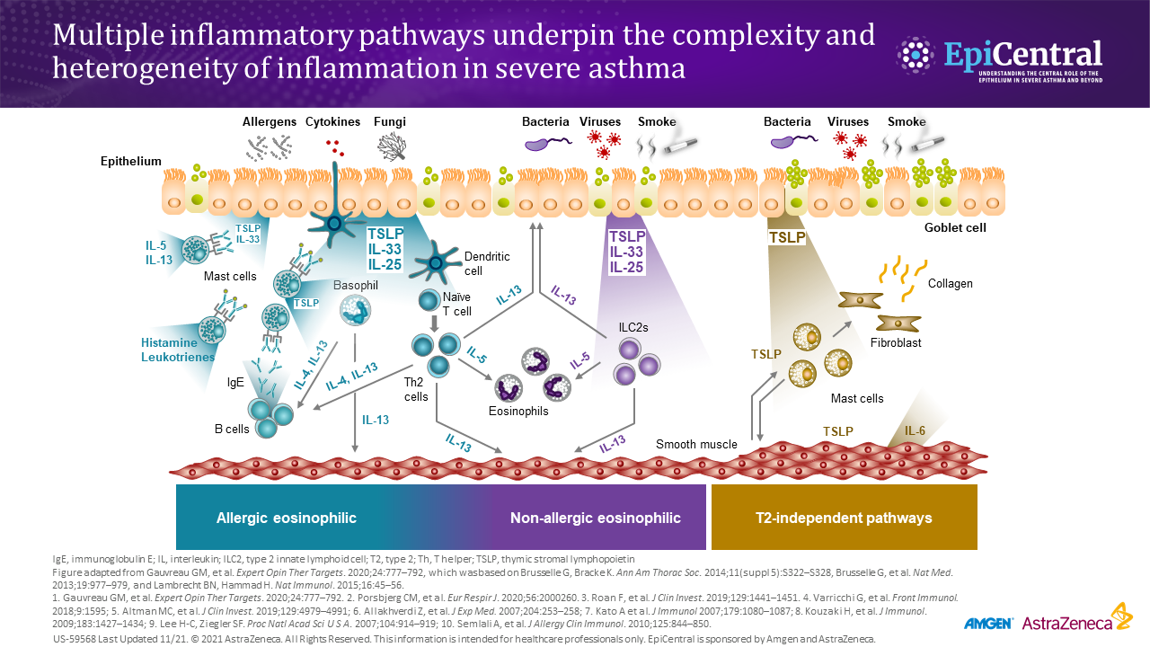Inflammatory pathways infographic