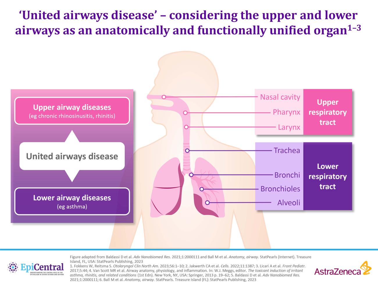 United airways disease - considering the upper and lower airways as an anatomically and functionally unified organ