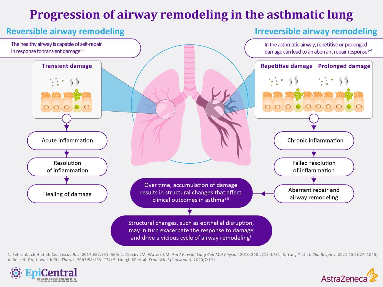 Progression of airway remodeling in the asthmatic lung