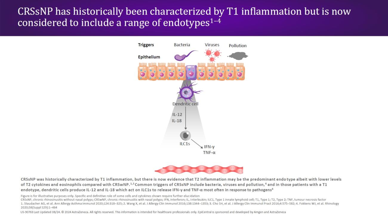 CRSsNP has historically been characterized by T1 inflammation but is now considered to include a range of endotypes