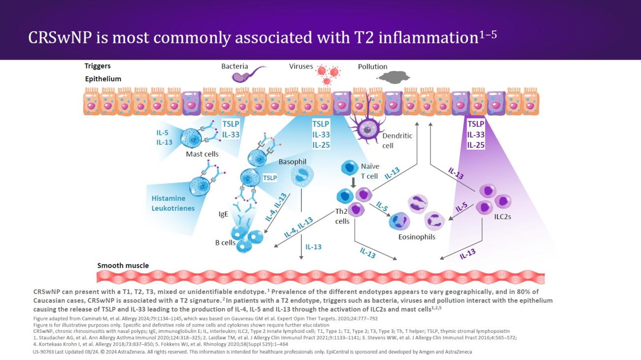 CRSwNP is most commonly associated with T2 inflammation