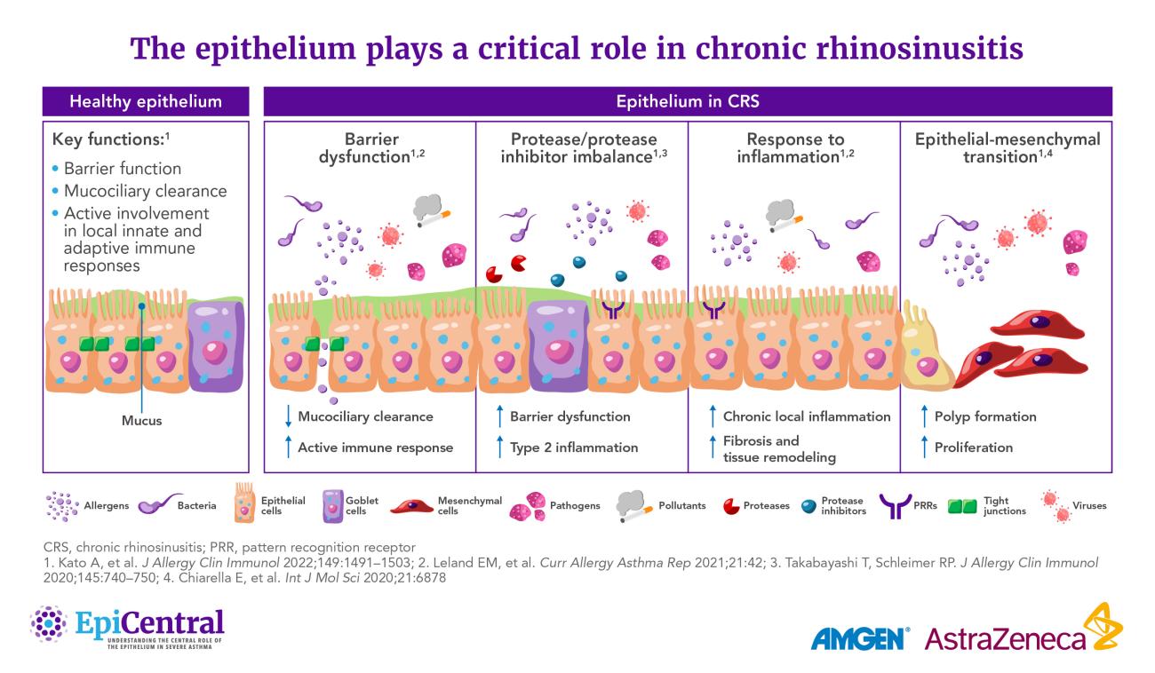 The epithelium plays a critical role in chronic rhinosinusitis