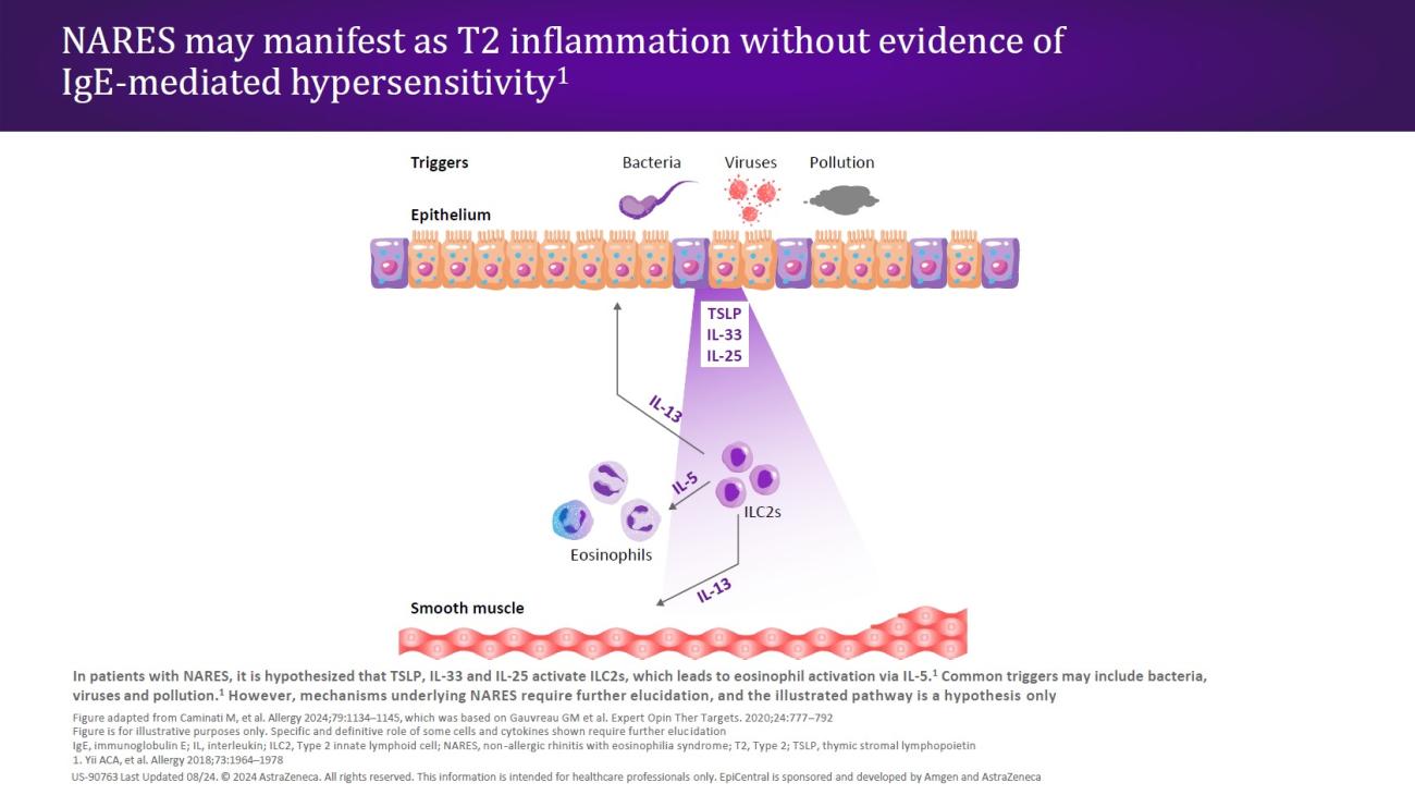 NARES may manifest as T2 inflammation without evidence of IgE-mediated hypersensitivity